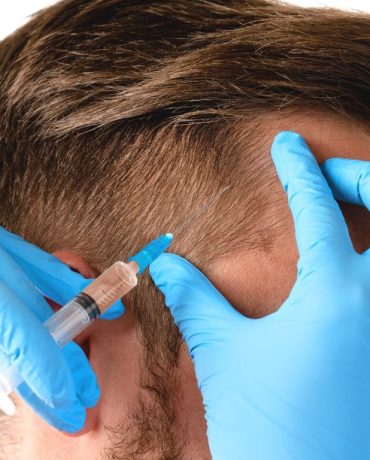 CAPILAR micropigmentación en Madrid en GB SKINCARE STUDIO - Grey Baez